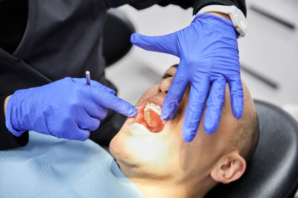 Best Dental Abscess Treatment in Raymond, WA